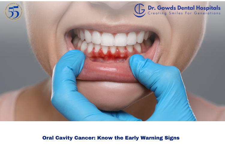 Dental Cyst vs Dental Abscess