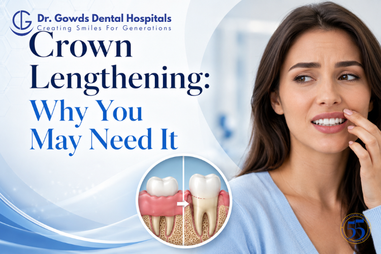 Crown Lengthening: Why You May Need It