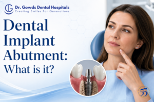 Dental Implant Abutment