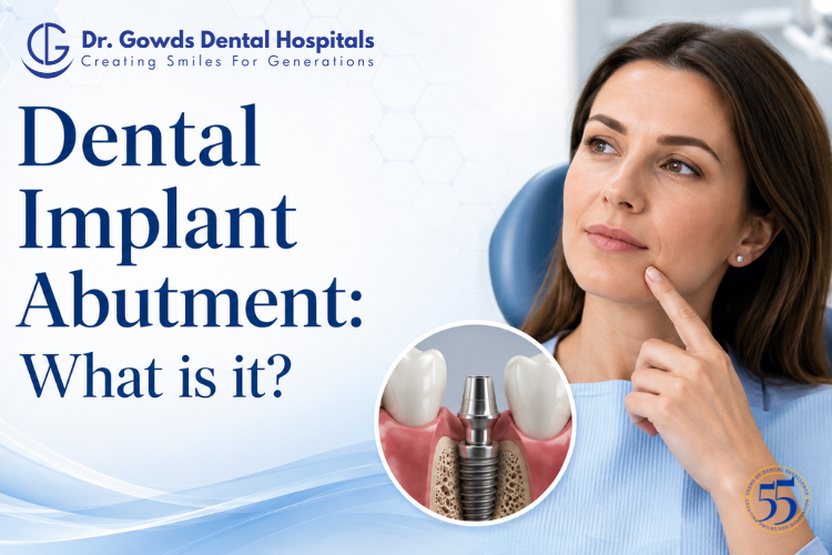 Dental Implant Abutment