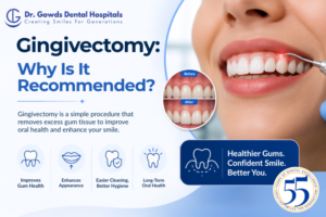 gingivectomy
