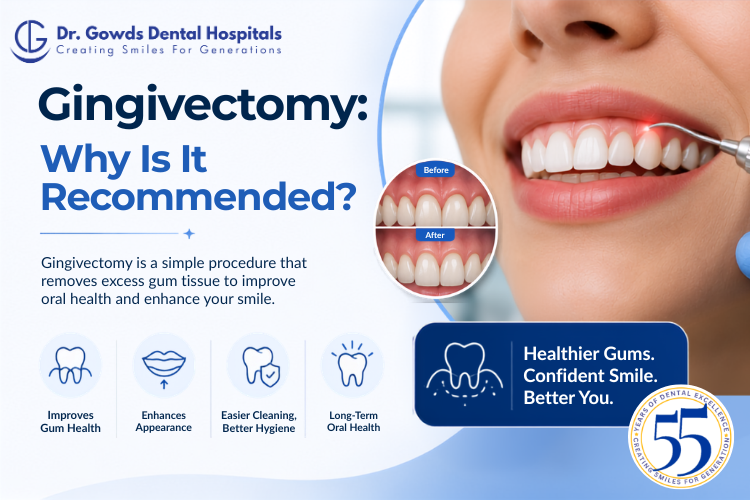 gingivectomy