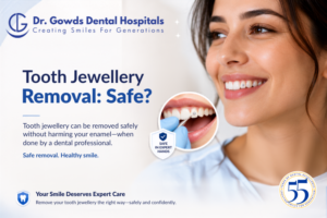 Tooth Jewellery Removal