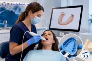 dental impressions