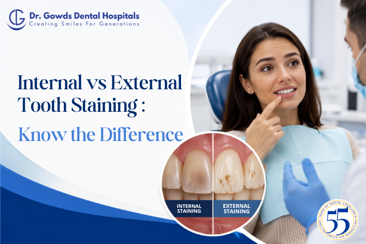 internal vs external tooth staining