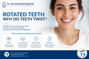 Rotated Teeth