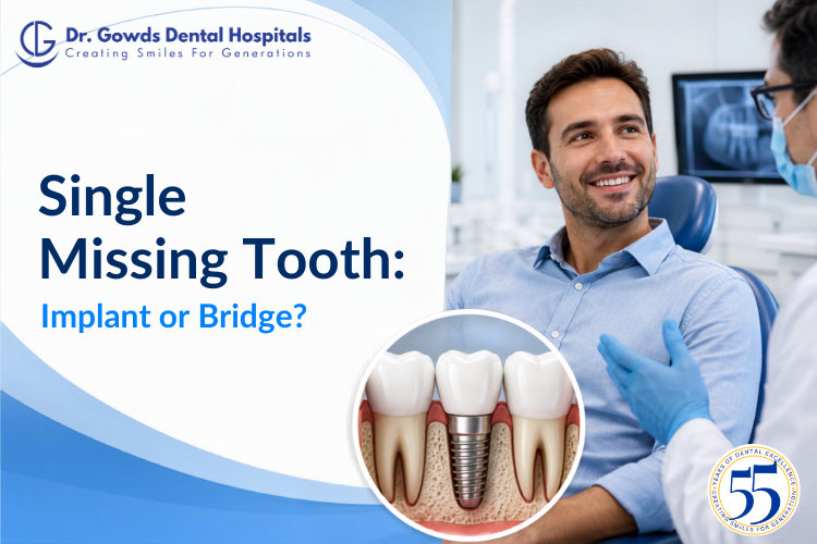 Single Missing Tooth