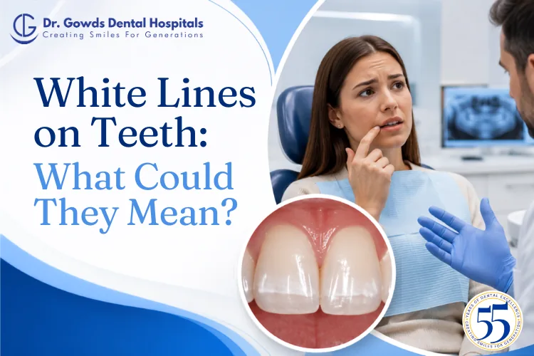White Lines on Teeth