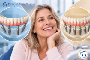 All-on-4 vs All-on-6 Dental Implants