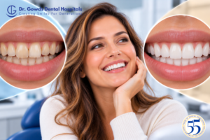 Hollywood Smile Makeover