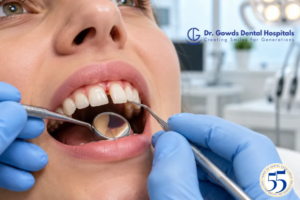 Subluxated Tooth
